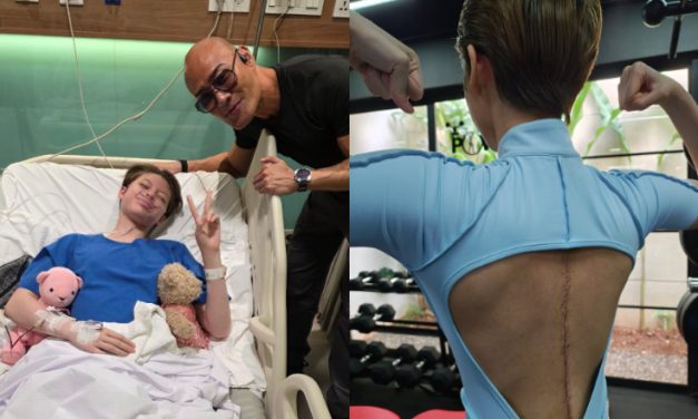 Nada Tarina Usai Operasi Skoliosis: Sakit Fisik, Tak Pernah Berisik