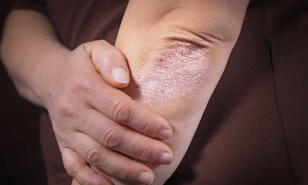 Siku Kering & Gatal: Kenali Penyebabnya Sebelum Jadi Parah!